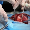 artificial-intelligence-flickr-310px heart surgery