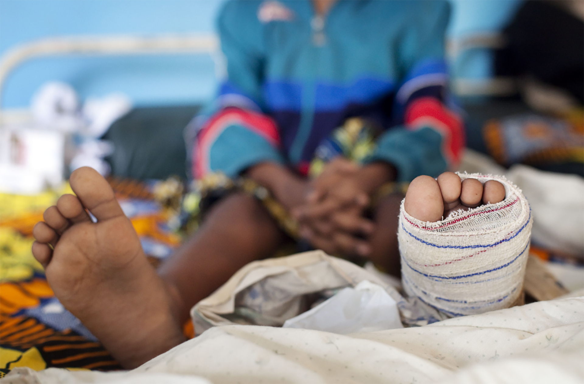 fifth-labnet-meeting- Albert Masias Buruli Ulcer patient under treatment