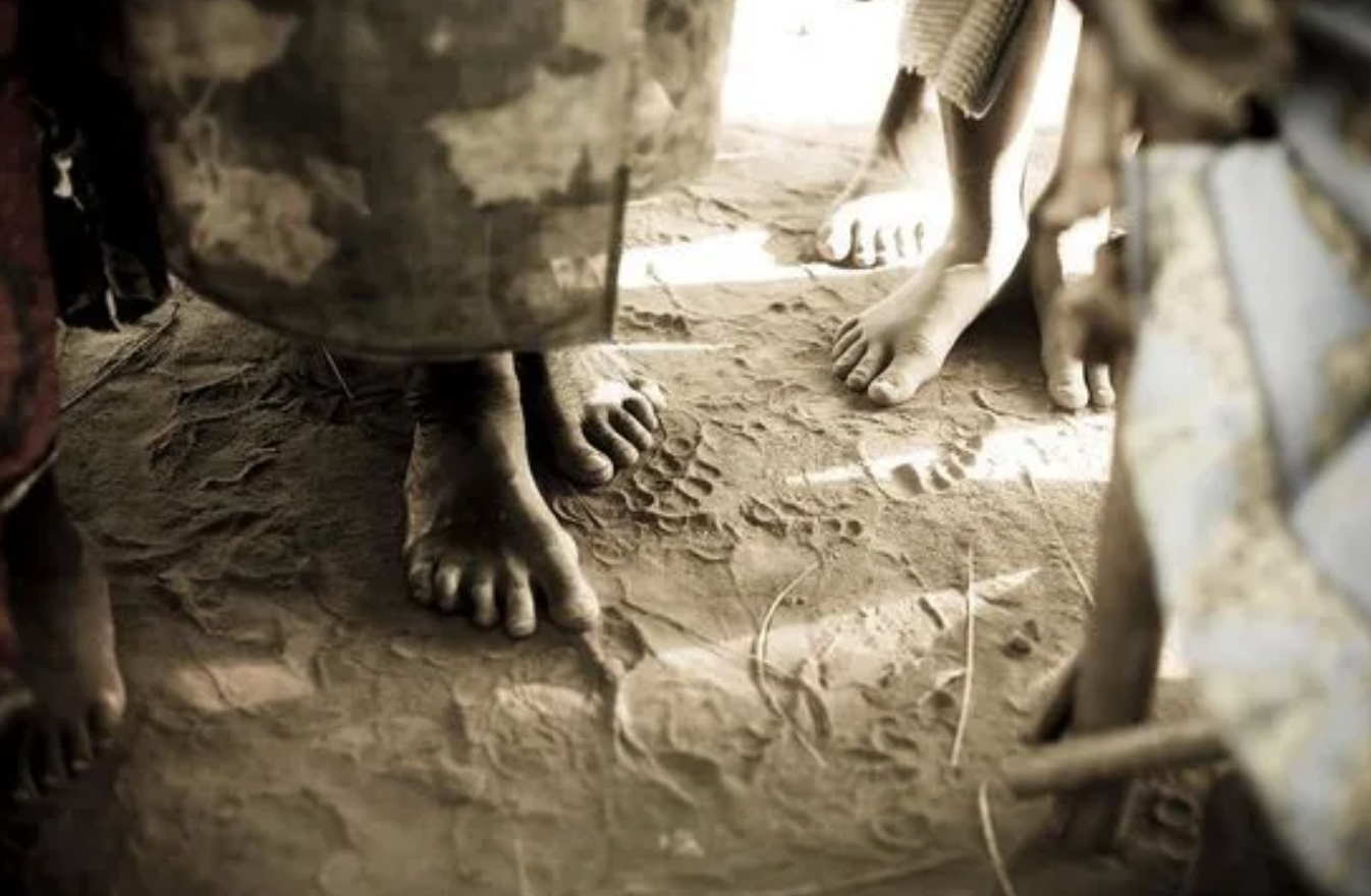 Chromoblastomycosis course thumbnail Chromoblastomycosis course thumbnail