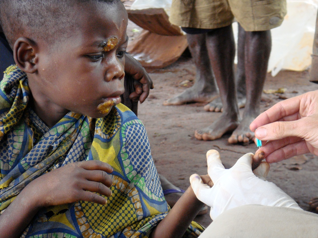 MSF_DSC03513_2 MSF_DSC03513_2