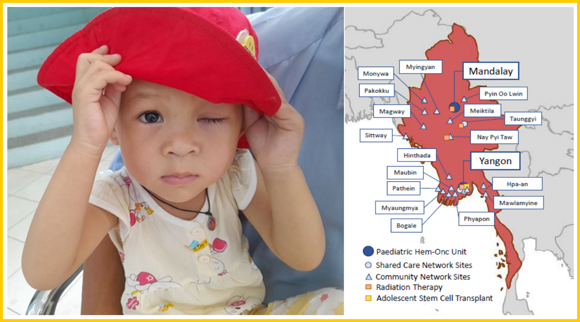 Improving care of children with cancer-MMR