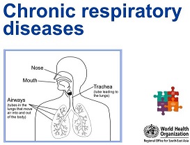 Chronic Respiratory Diseases_Flip Chart